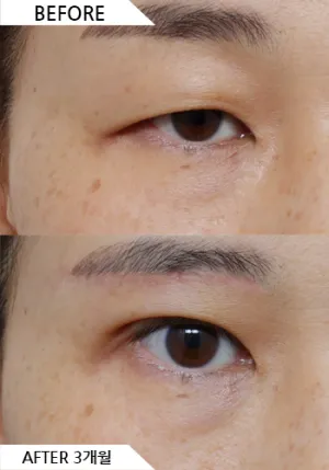 Before