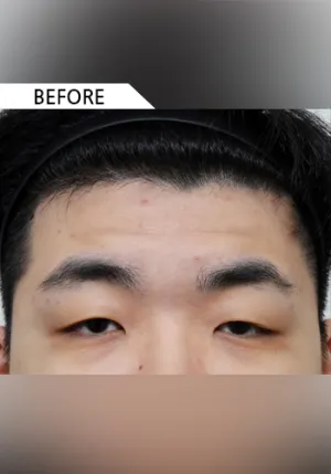 Before