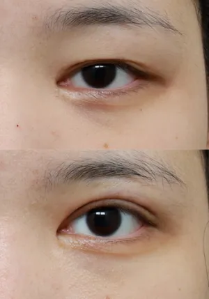After