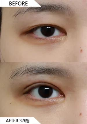 Before