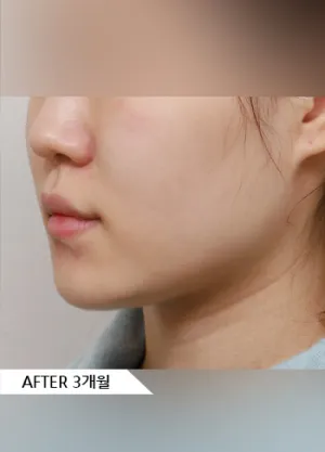After