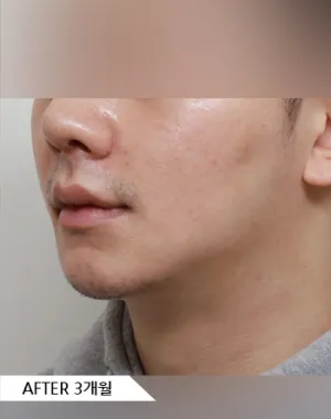 After
