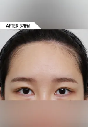 After