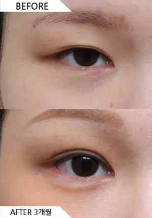 Before