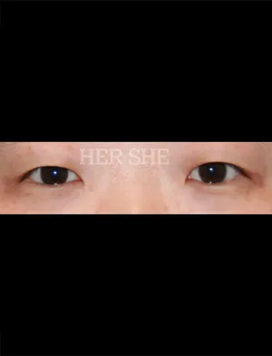 Before