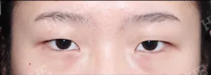 Before