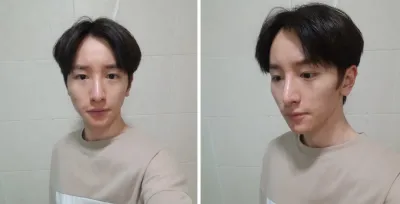 顏面輪廓、隆鼻、全臉脂肪移植