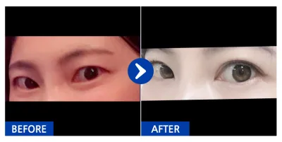 [Babytalk] 雙眼皮 / 第3個月 / 暱稱：Hanasama