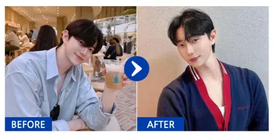 [江南姐姐] 眼底脂肪重排 / 1個月 / 暱稱：到底缺什麼啊靠