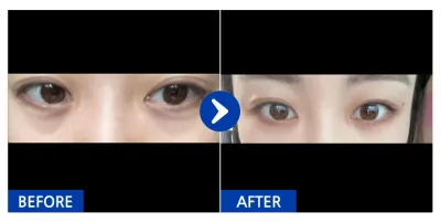 [Babitalk] 自然黏連 / 第2週 / 暱稱：융박