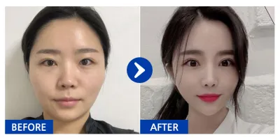 [Babytalk] 面部輪廓 / 第3個月 / 暱稱：文浩文