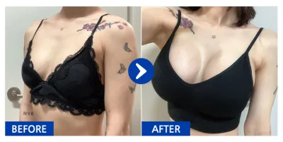 [Babytalk] 胸部(魔滴) / 第2週 / 暱稱：三隻小熊