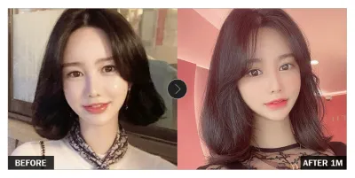 [Babytalk 心得] 眼部整形滿一個月 / 暱稱：y3409