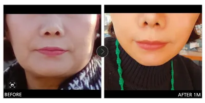 [江南姐姐評價] 迷你拉皮 / 滿1個月 / 暱稱：Smile(敏京)