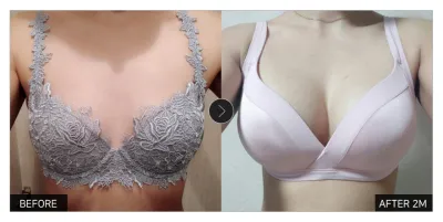 [江南姐姐評價] 隆乳第2個月 / 暱稱：Bi-tting