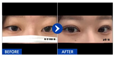 [江南姐姐] 自然黏連 / 第1個月 / 暱稱：easyn