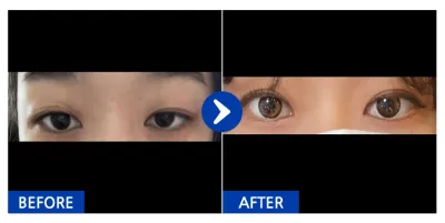 [Babitalk] 自然黏連 / 第2週 / 暱稱：Teuni與朋友們