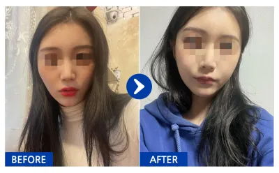 [Babytalk] 臉部輪廓 / 1個月 / 暱稱：보르으음달