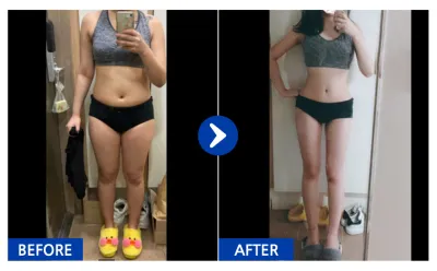 [江南姐姐] 全身抽脂 / 第3個月 / 暱稱：棉花糖Mogu