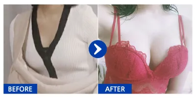 [江南姐姐] 隆乳 / 第2個月 / 暱稱：起司多多