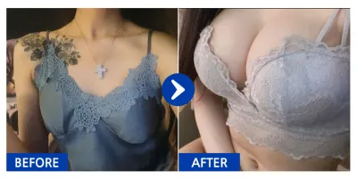 [江南姐姐] 隆乳 (賽彬微紋理) / 第9個月 / 暱稱：코손실와용