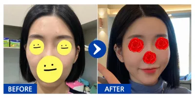 [江南姐姐] 脂肪移植 / 暱稱：泰希嘻嘻嘻