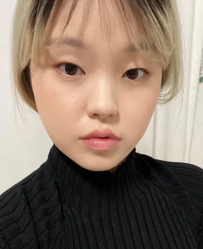 [眼睛] 몽시리 - 非切開眼瞼下垂矯正