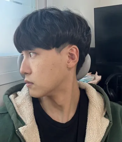 [男性] 븽븽 - 切開式眼瞼下垂矯正、隆鼻、輪廓三項