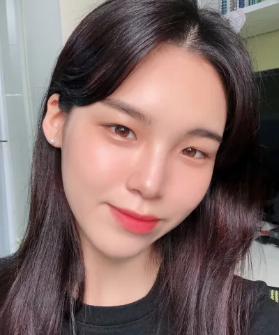 [眼睛] 強推 - 埋線雙眼皮（重修）