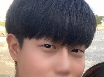 [男性] 柳康 - 切開式眼瞼下垂矯正