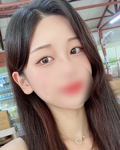 [眼睛] 晶瑩剔透 - 縫式雙眼皮（重修）,下眼瞼下至