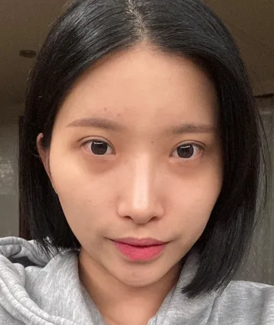 [眼睛] 幼貓眼 - 開後眼角、下至