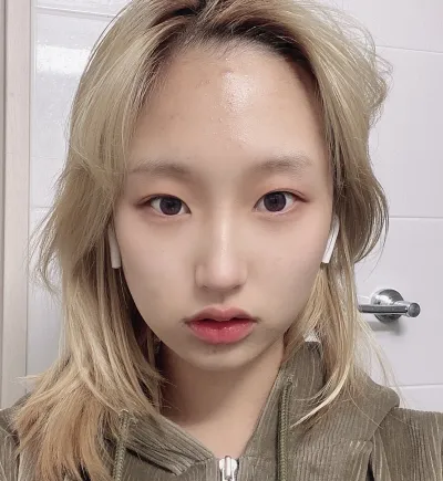 [眼睛] 雪花冰 - 非切開眼瞼下垂矯正、開後眼角