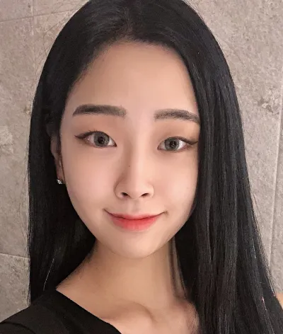 [眼部] NaRa - 埋線雙眼皮、開後眼角、開下眼角