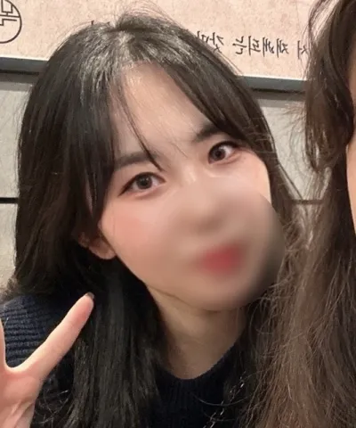 [眼部] 喔啾啾 - 切開雙眼皮重修手術