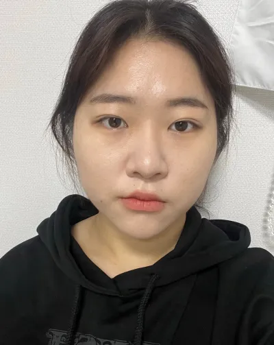 [眼睛] Cherry Jelly - 開後眼角、開下眼角