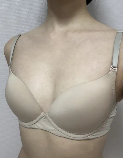 [隆胸] Dama - 胸部