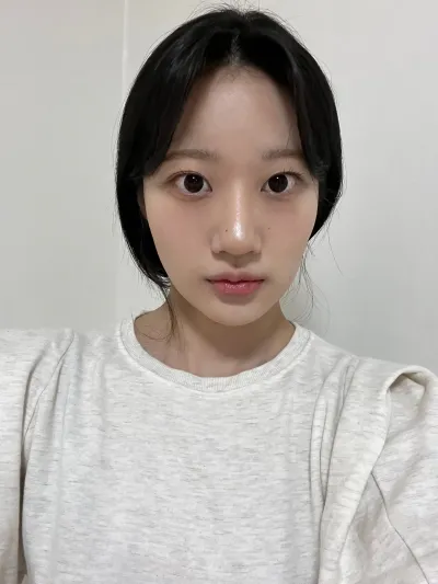 [眼睛] 多瓏伊 - 埋線雙眼皮，非切開眼型矯正