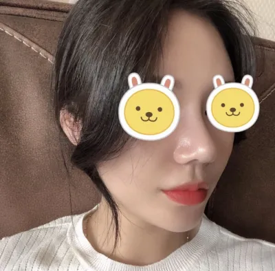 [鼻] 王八鼻 - 鼻