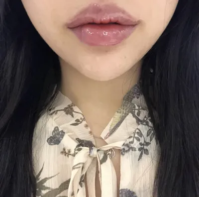 [微整] 嘟嘟ㄉㄧㄚㄉㄧㄚㄋㄧㄋㄧ - 填充劑