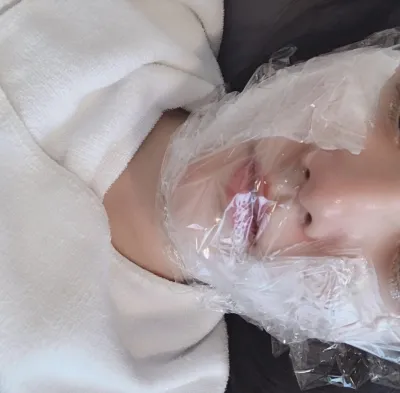 [微整] 酷塑 - 音波拉提