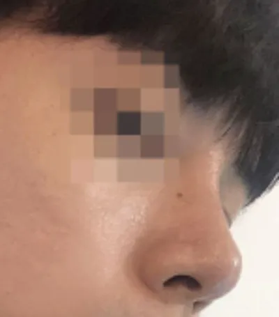 [鼻] COZ802 - 鼻樑