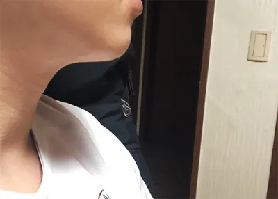 [皮膚] ㄱ강 - 音波拉提