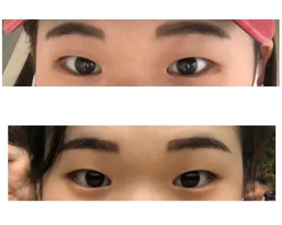 [眼睛] Zhi Bamba - 眼睛