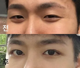 [眼睛] CheerNio - 眼睛