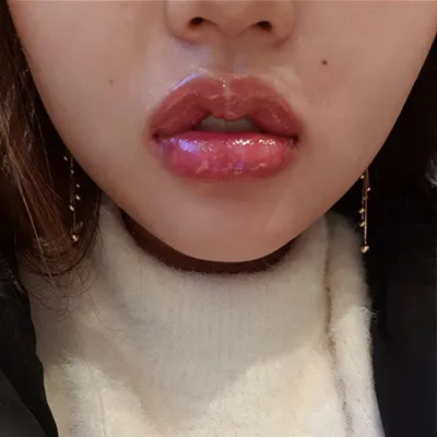 [微整形] ss5773 - 嘴唇