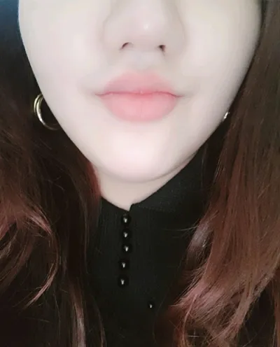 [微整形] Allookdallook Milk - 鼻雕塑注射