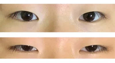 [眼睛] 뱖 - 眼睛