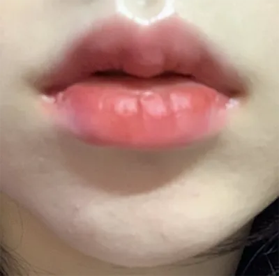 [微整] m8n - 嘴唇