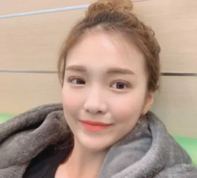 [眼睛] 眼部整形後記 - 眼睛